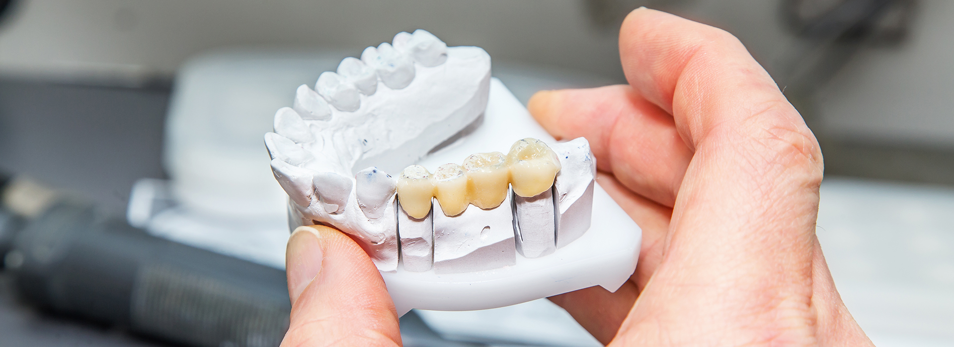 Pauly Dental | Extractions, Implant Dentistry and Root Canals