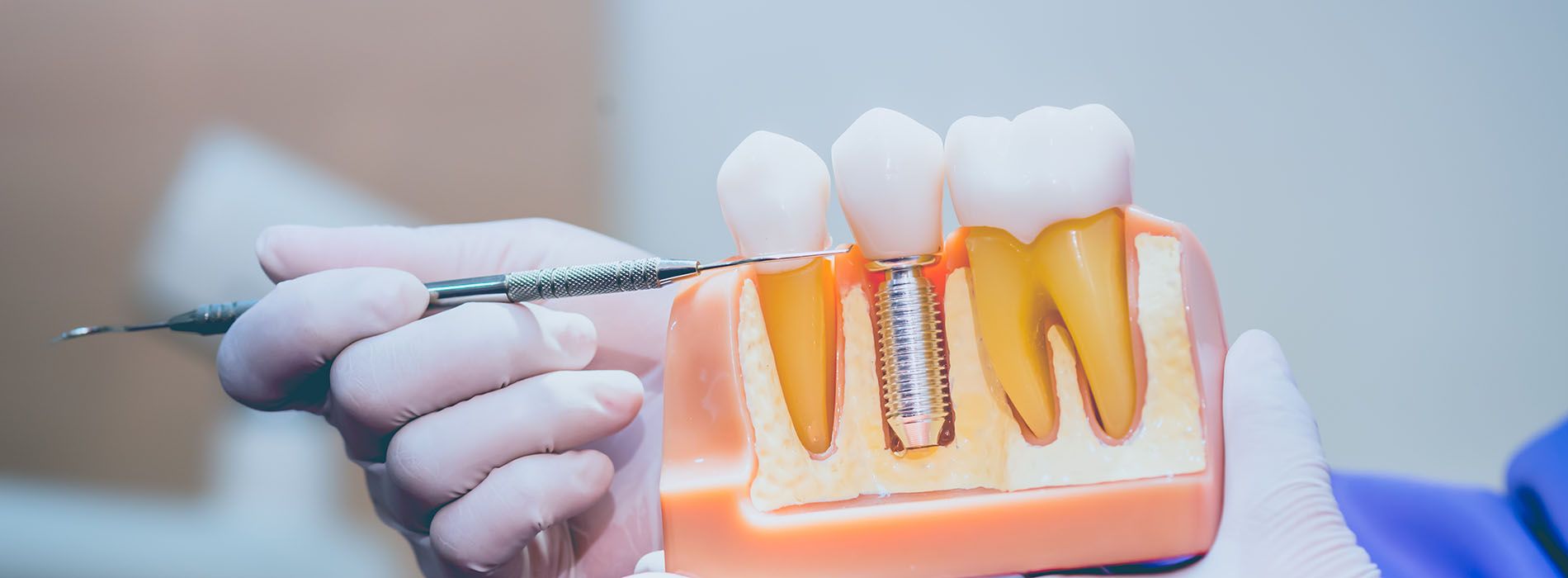 Pauly Dental | Dentures, Preventative Program and All-on-4 reg 